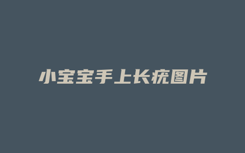 小宝宝手上长疣图片